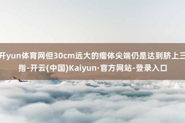 开yun体育网但30cm远大的瘤体尖端仍是达到脐上三指-开云(中国)Kaiyun·官方网站-登录入口